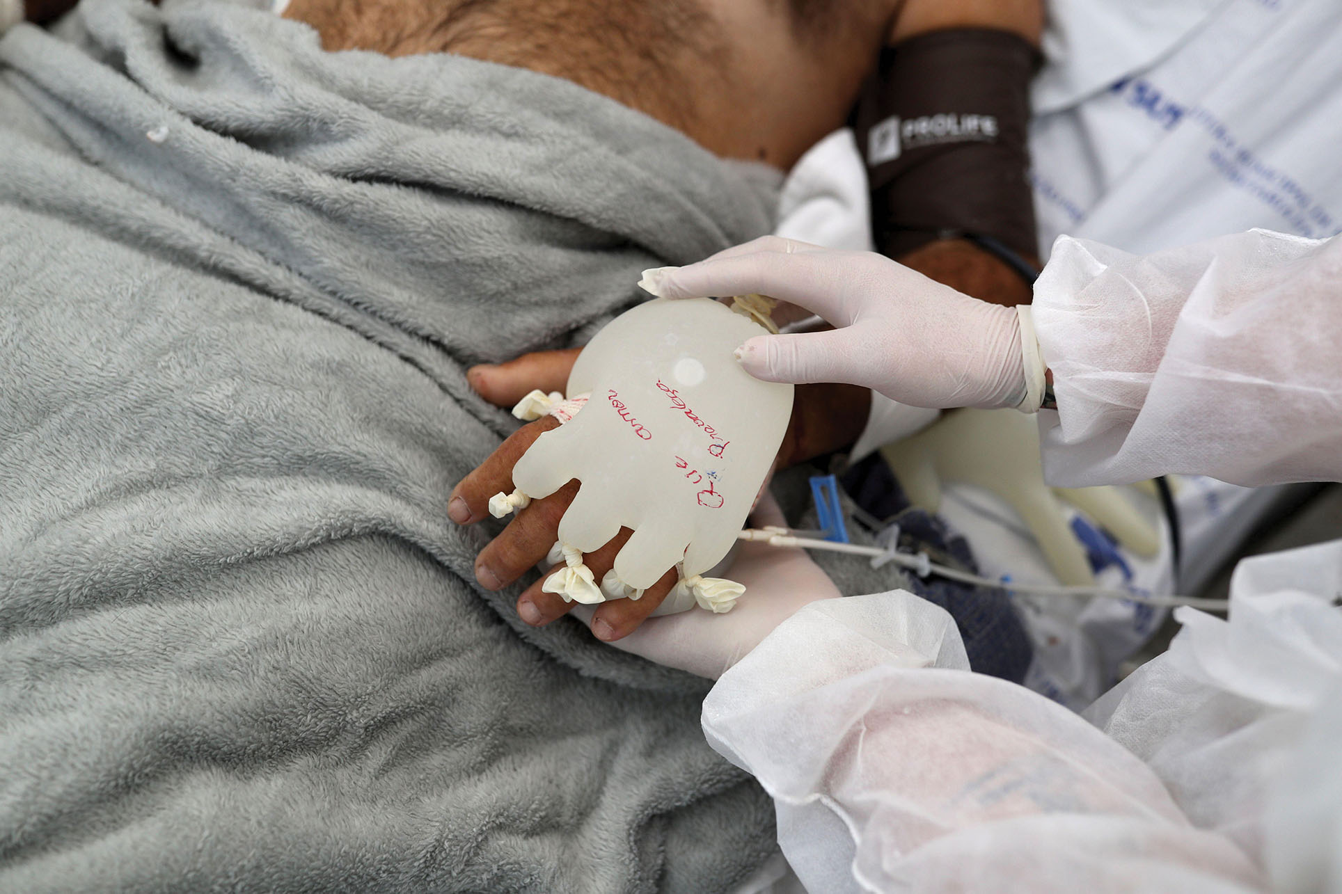 A nurse puts a warm water-filled glove on a Covid-19 patient in Brazil,  April 2021. The phrase on the glove reads “May love prevail.” (Photo by Amanda Perobelli/REUTERS.)